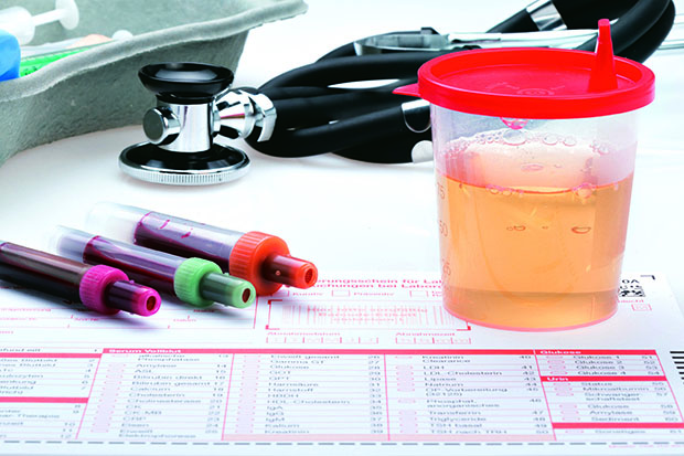 62369877 - urine and blood sample on a form for examination